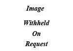 image-withheld